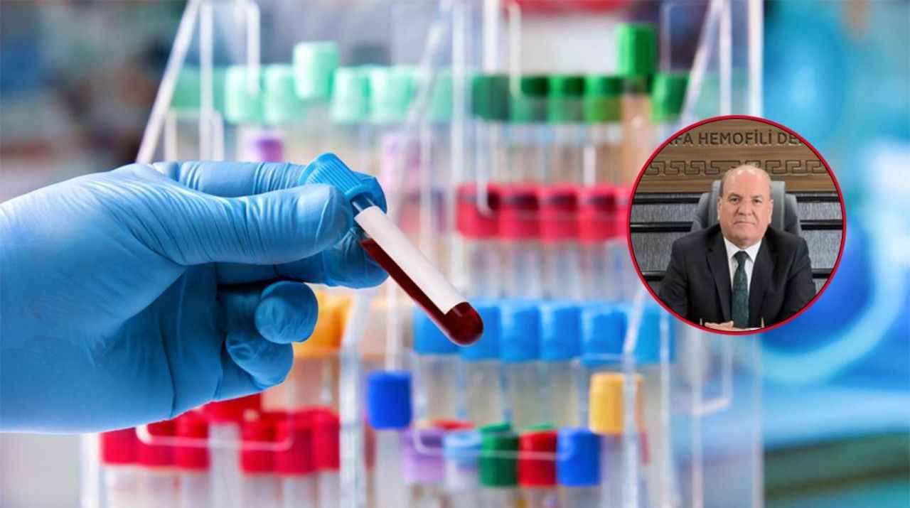 Urfa’da kan hastalığı bulunan 2 bin kişi doktorsuz kaldı