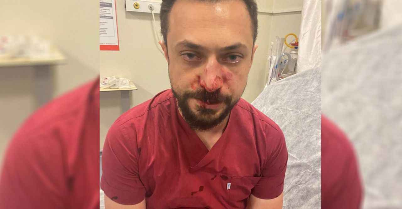 Urfa'da aynı doktora ikinci kez saldırı! Bu kez burnu kırıldı...