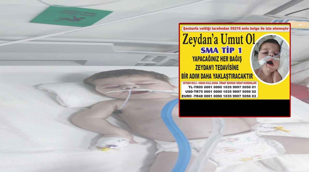 Urfa’da SMA’lı Zeydan bebek destek bekliyor