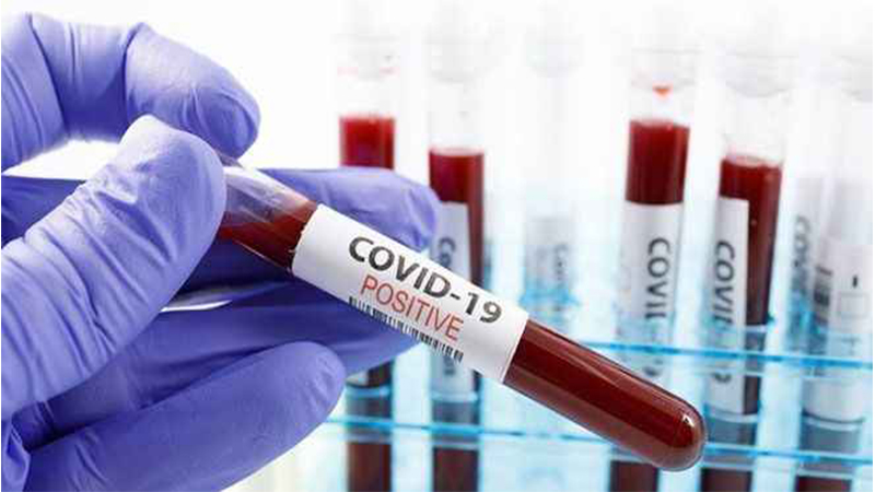 Koronavirüs cezalarının iadesi için başvuru formu yayımlandı